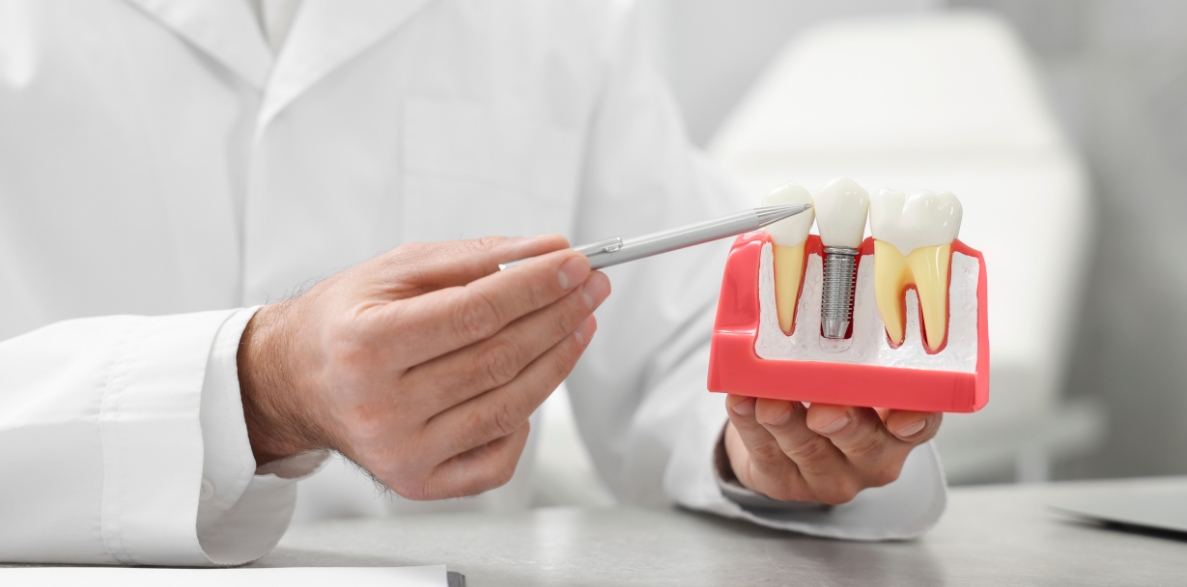 can you get dental implants if you have gum disease what you need to know
