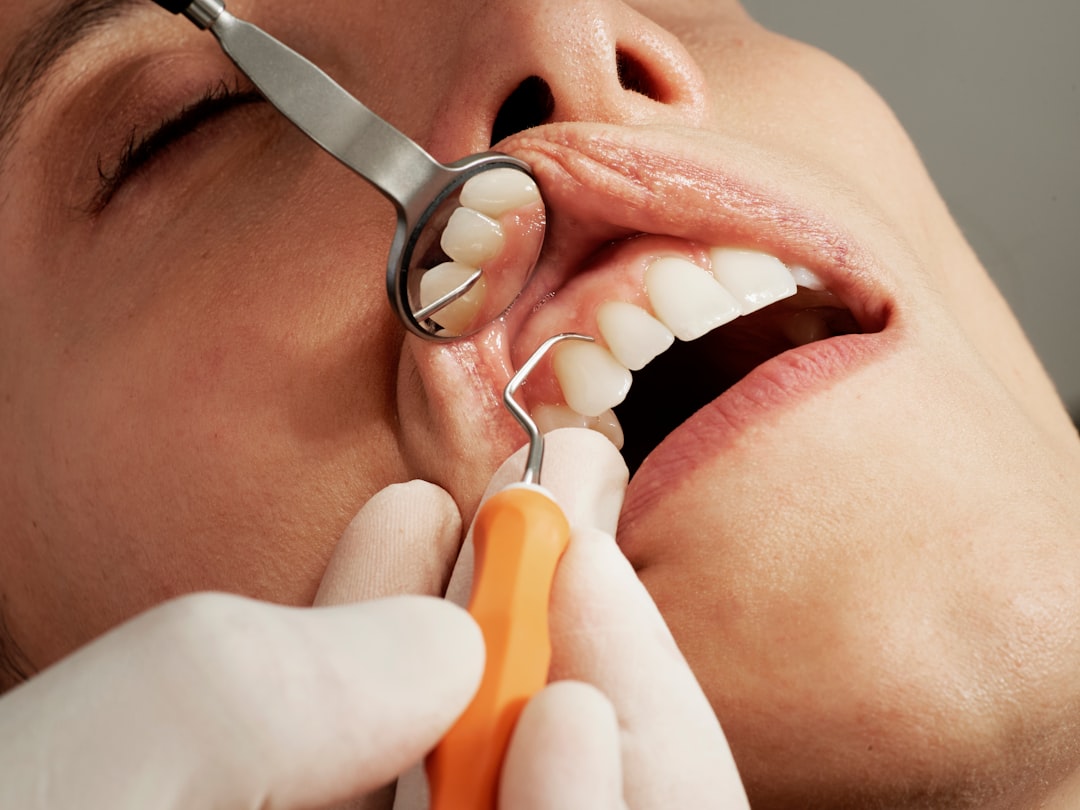 Teeth Cleaning Cary