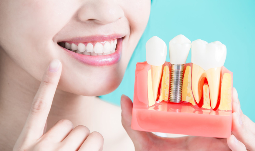 Tips for Caring for Your Dental Implants Maintaining Long-Term Oral Health