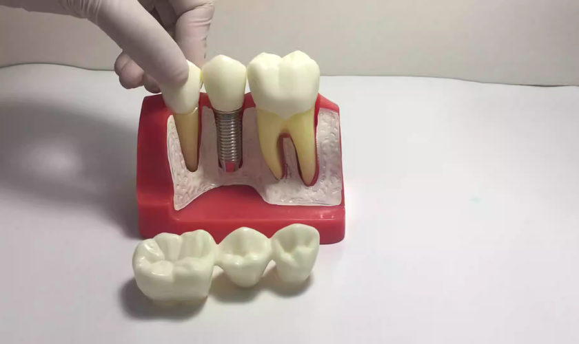 Smile Restoration 101 How Restorative Dentistry Can Transform Your Confidence