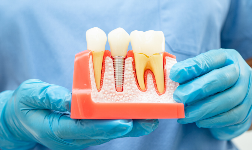 post root canal diet tips