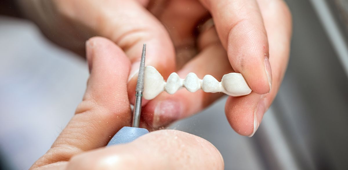 Dental bridge being prepared for fitting or repair