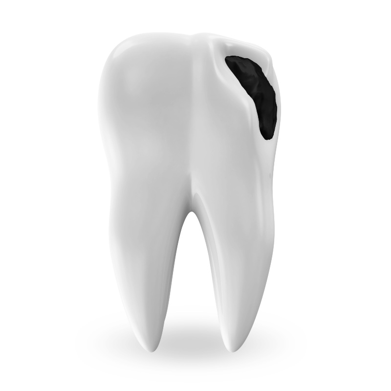 broken tooth treatment grants pass