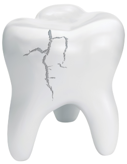 crack tooth
