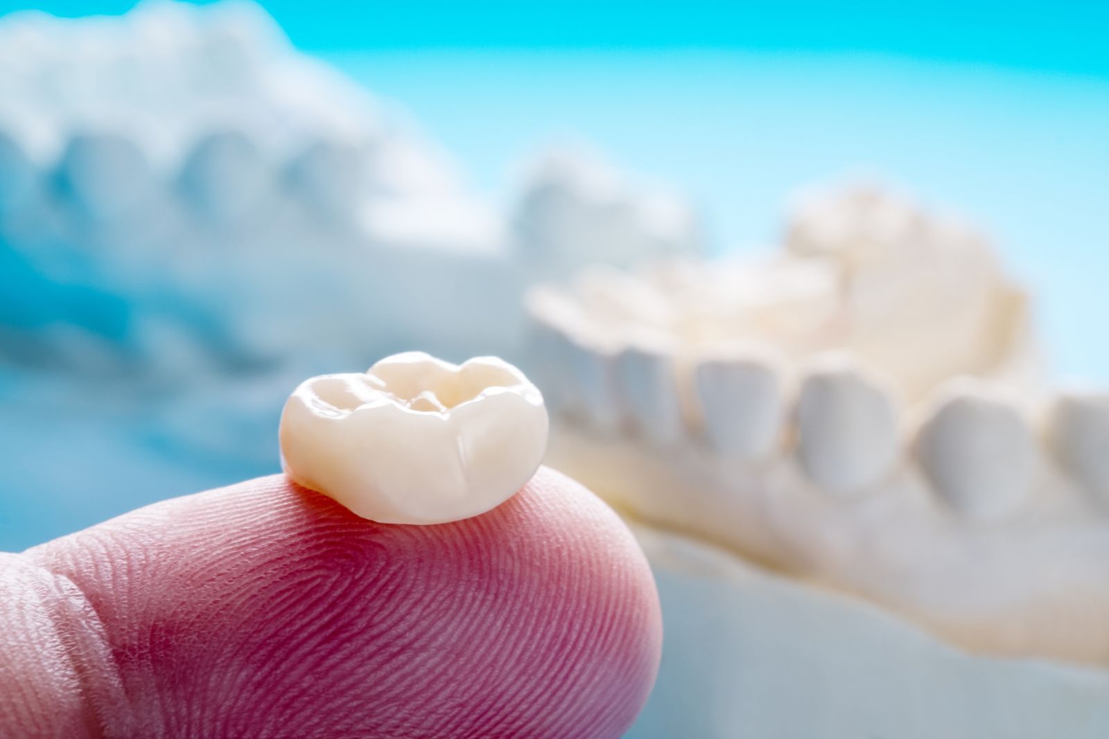 dental crowns grants pass