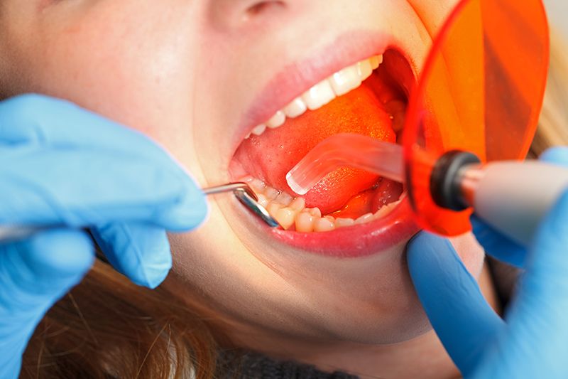 dental fillings grants pass