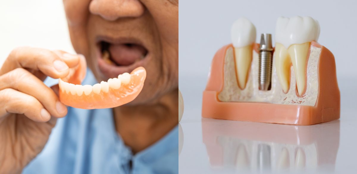 close-up of dentures and dental implant model comparing tooth replacement