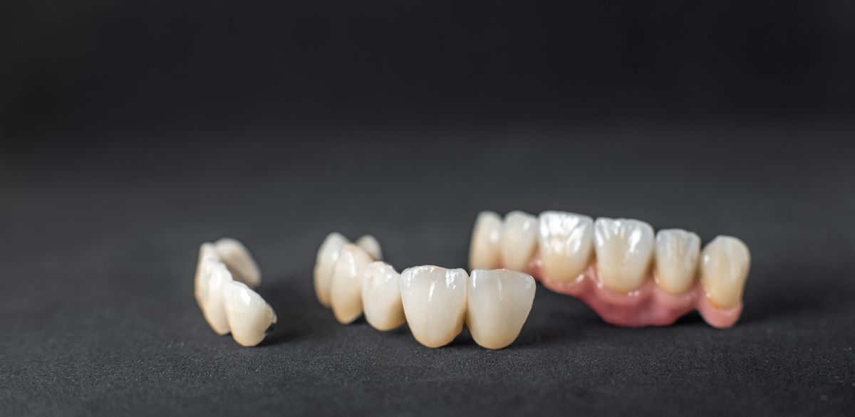 dental crowns care guide