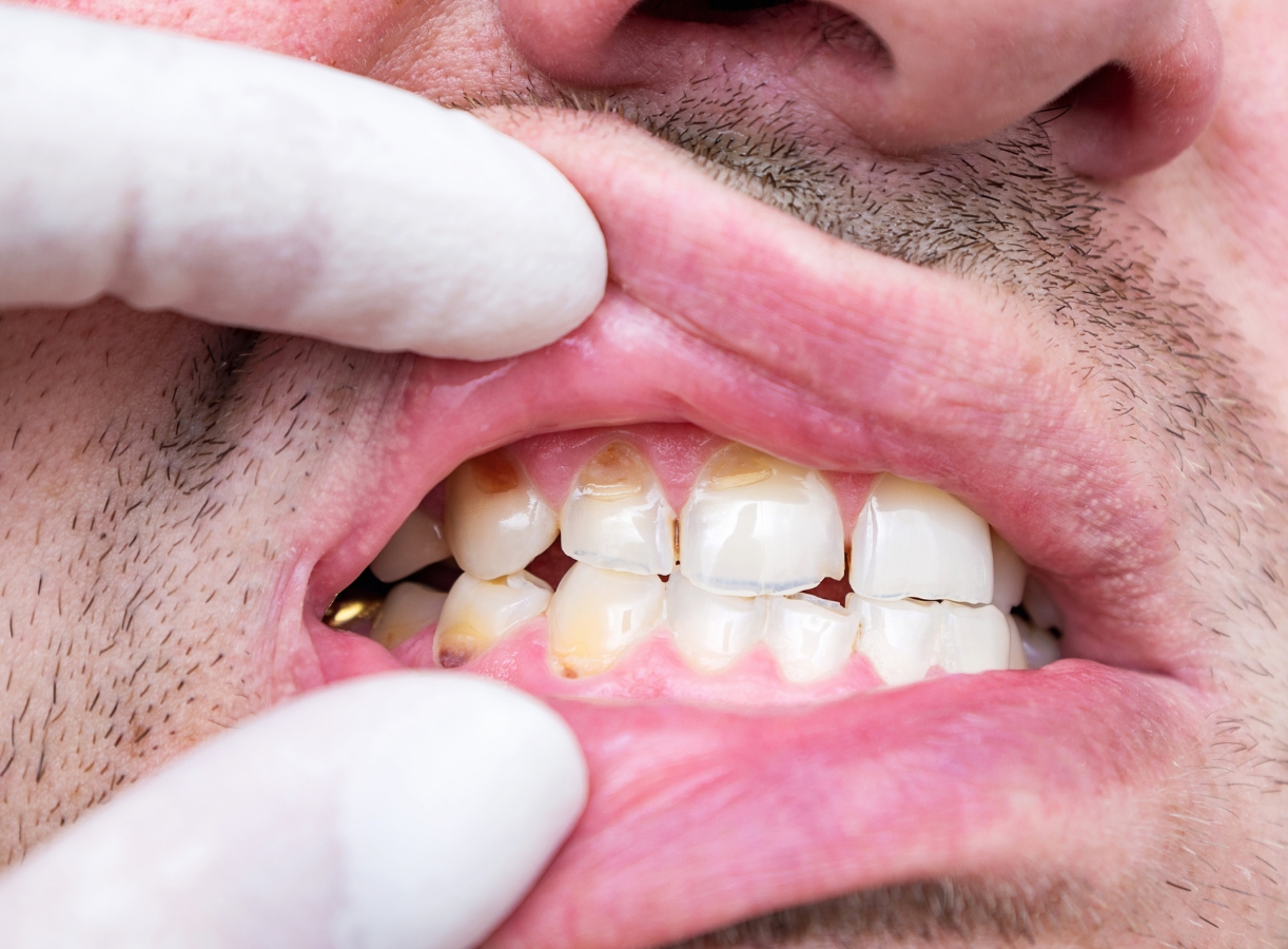 can tooth enamel grow back