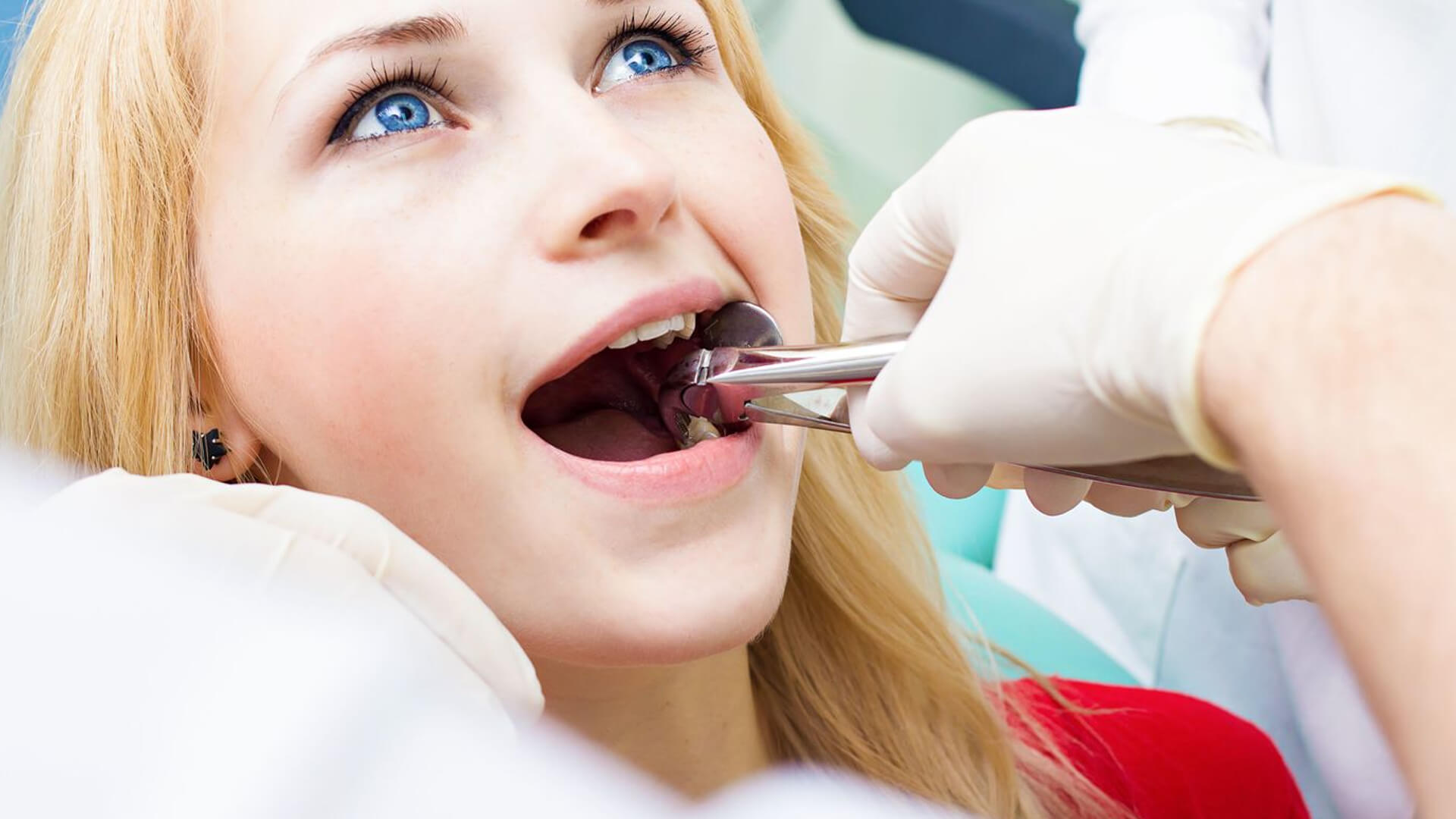 Tooth Extraction 101: What To Expect Before, During, And After