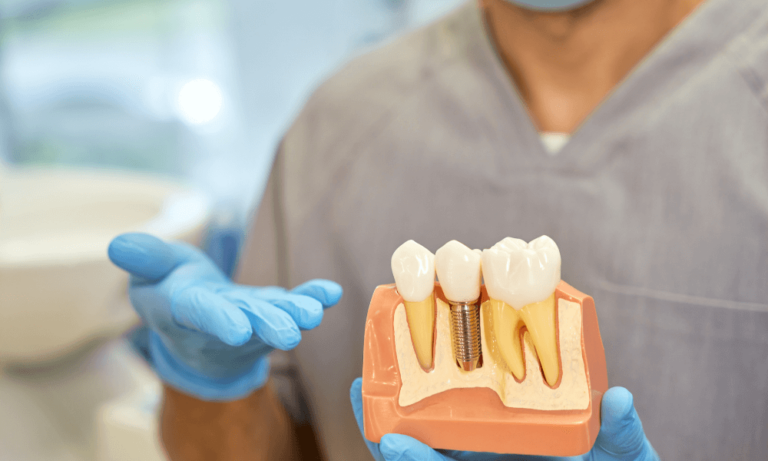 Signs You Could Benefit from Dental Implants