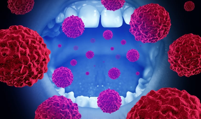 oral cancer screenings life saving benefits