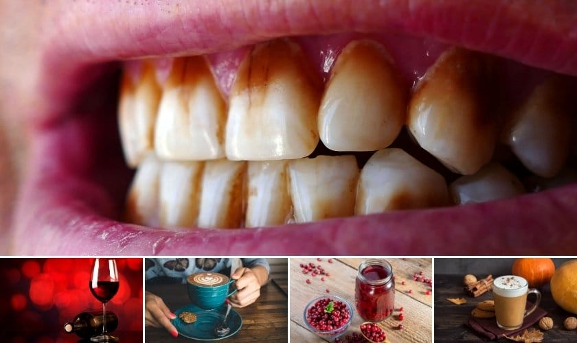 how thanksgiving beverages can stain your teeth