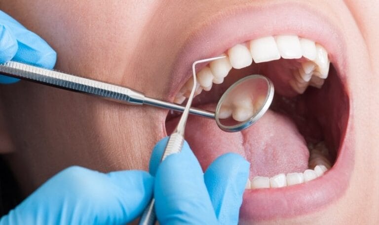 regular teeth cleaning reduces cavity risk