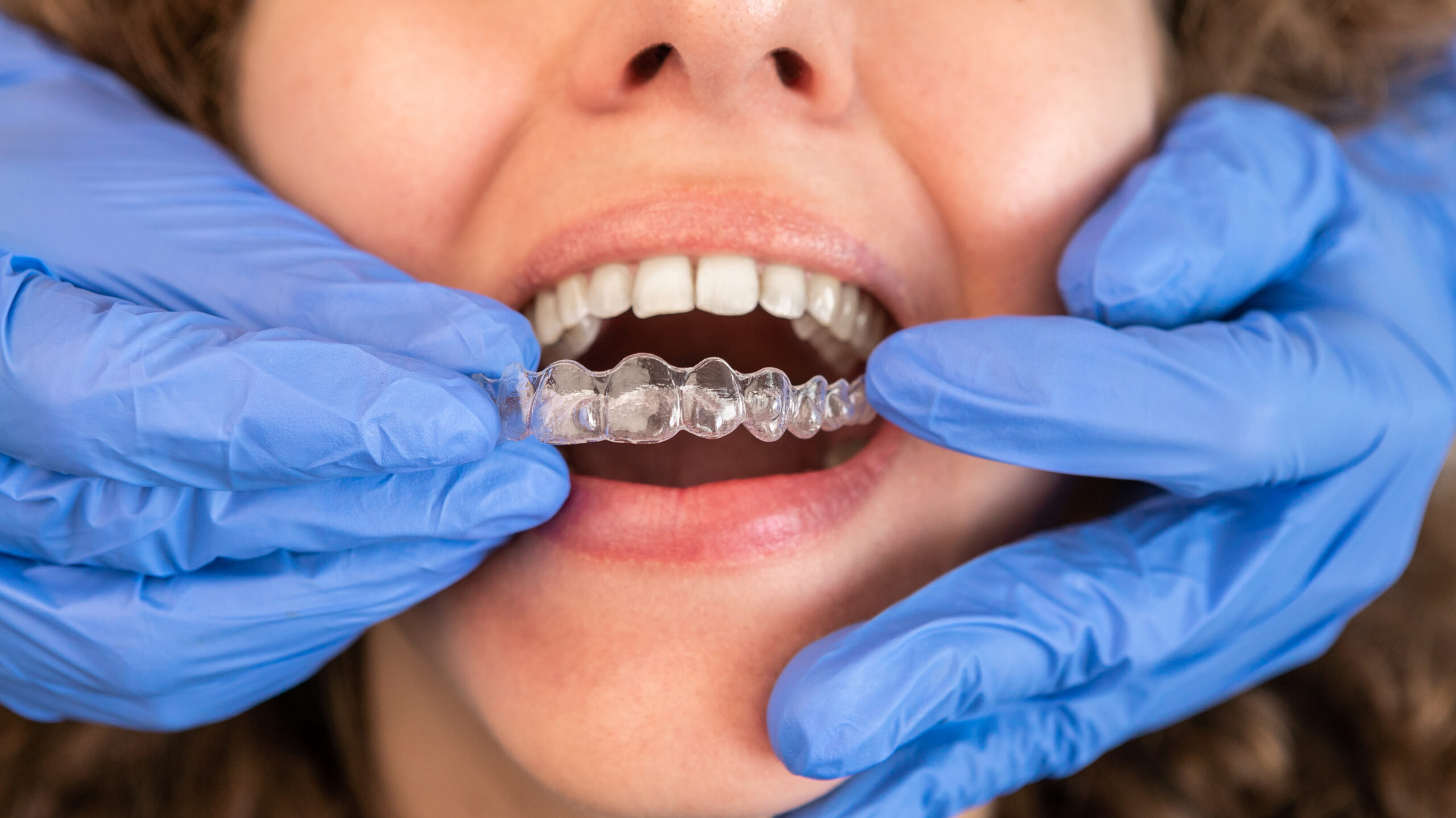 fix gum cuts from invisalign aligners