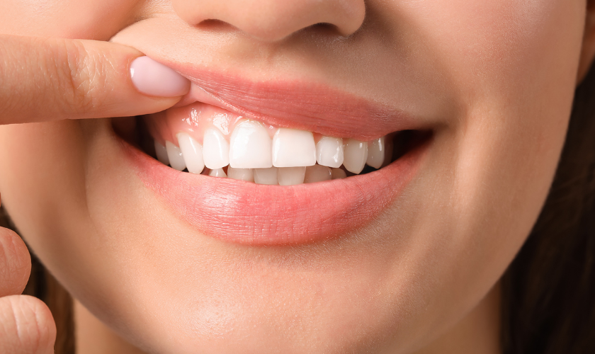 Gums Healthy