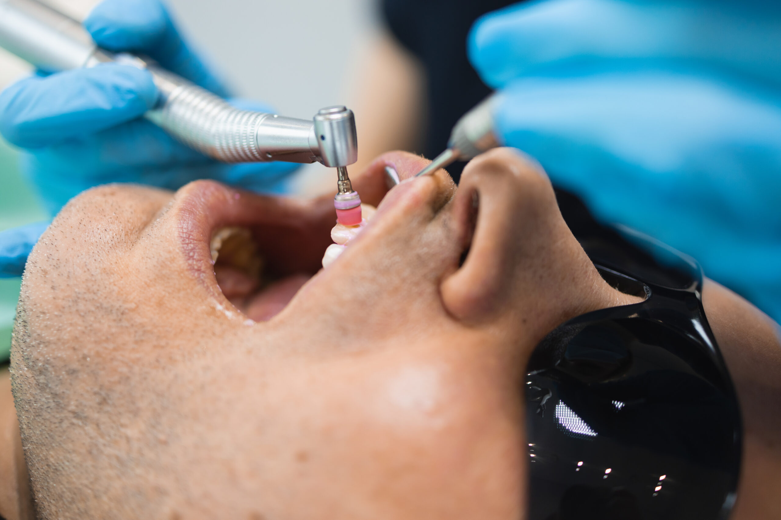 Dentist doing teeth cleaning procedure for male patient in Plant City