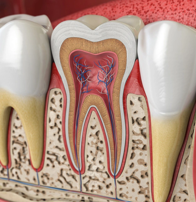 Root Canals in Plant City, FL - Horizon Dental Designs