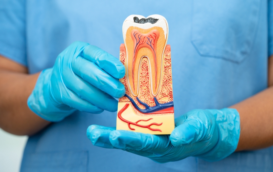 Root Canal Treatment in Plant City, IL