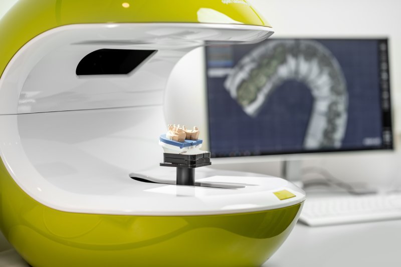 Featured image for “Feast Without Fear: Navigating Thanksgiving with Clear Aligners”