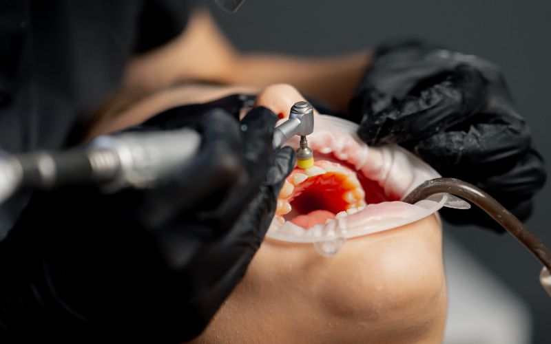 Featured image for “Why Periodontal Care Matters? Protect Your Gums For A Lifetime”