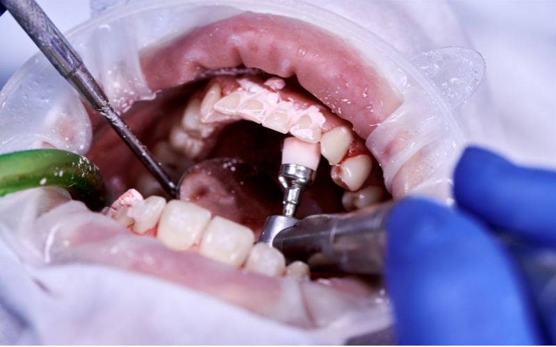 Featured image for “From Toddlers To Seniors: Why General Dentistry Fits All Ages”