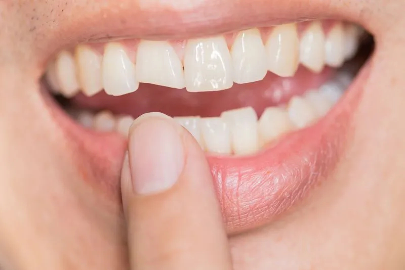 Emergency Dental Care For Consistent Tooth Pain at Flink Family Dentistry Carrollton