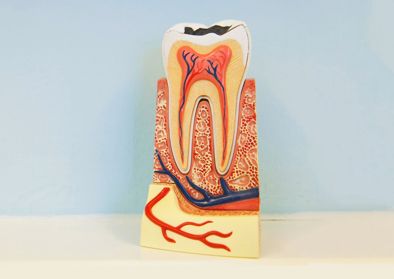 Root Canal Therapy in Kyle, TX