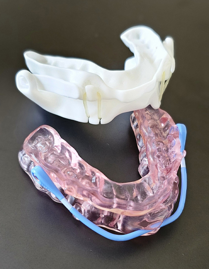 dental implants tustin