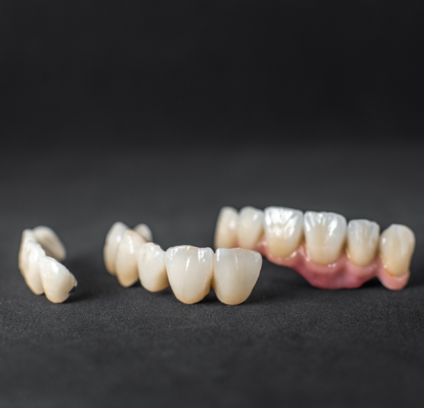 Dental Crowns in Phoenix, AZ