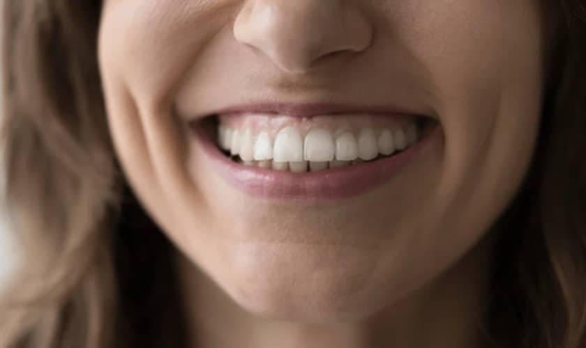 can gummy smiles be fixed