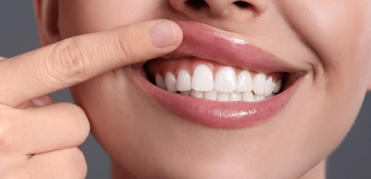 Daily Habits for Cleaner and Healthier Gums