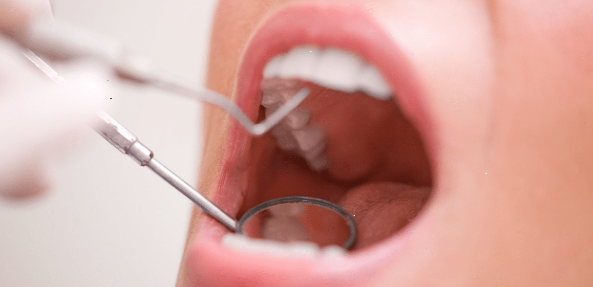 More Than Just a Cleaning: The Hidden Benefits of Regular Dental Exams