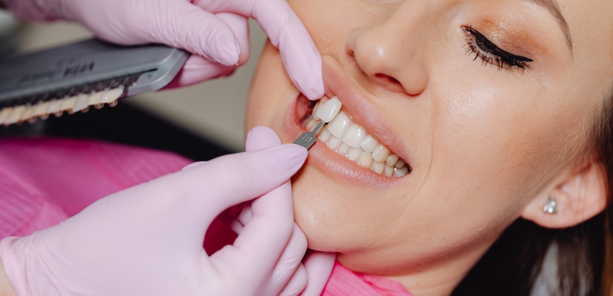 Do Veneers Hurt? Debunking Common Myths