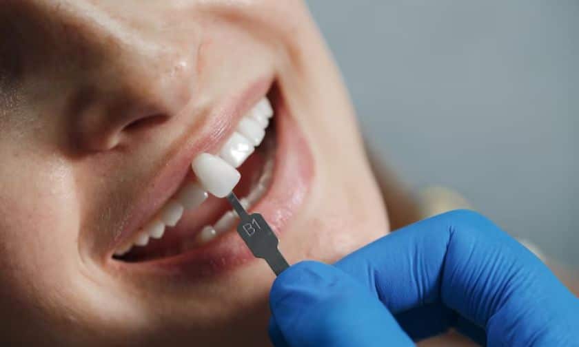 veneers unveiled get a naturally flawless smile