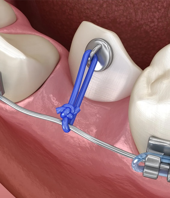 Canine Exposure in Toms River, NJ - North Dover Dental