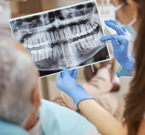 Digital X-Ray in Toms River, NJ - North Dover Dental