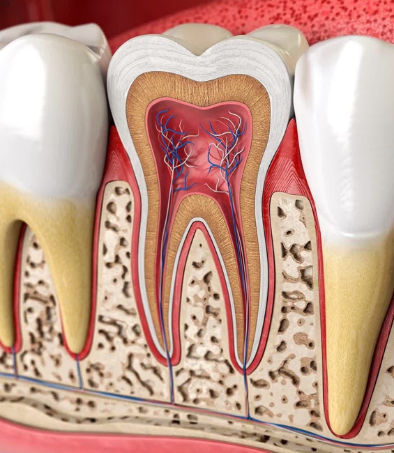 Root Canals in Toms River, NJ - North Dover Dental