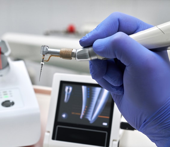 Rotary Endodontics in Toms River, NJ - North Dover Dental