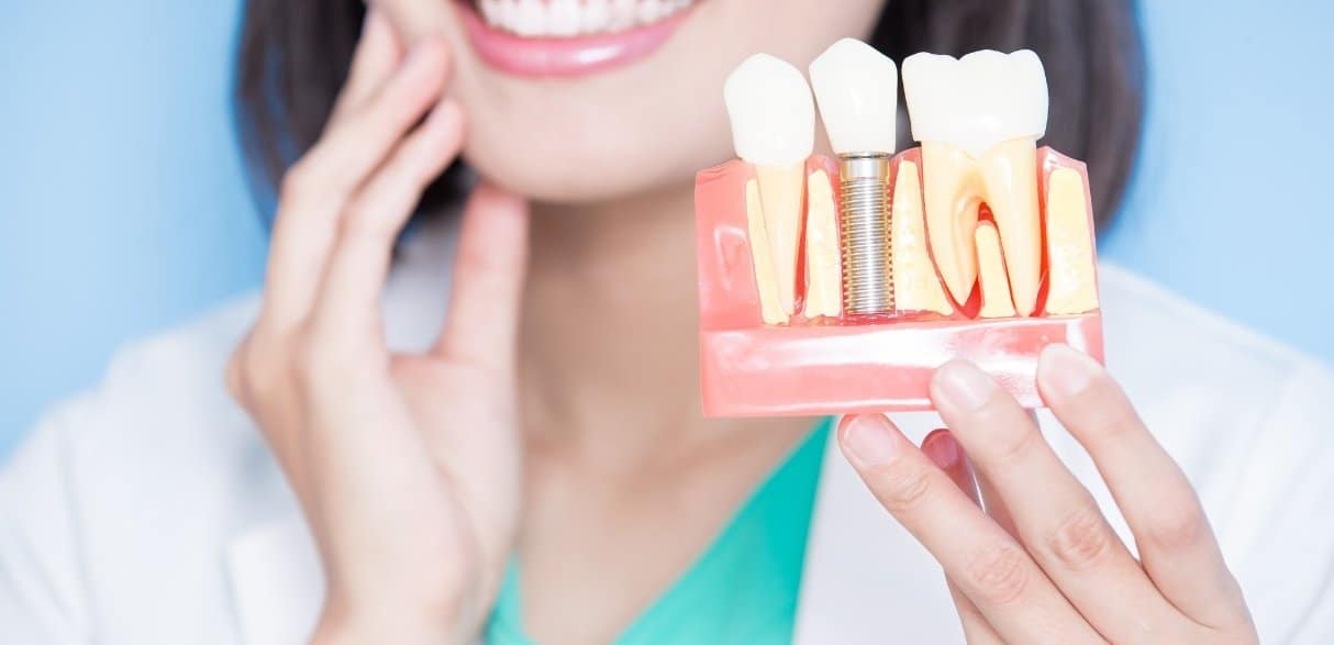 what you should not do before getting dental implants