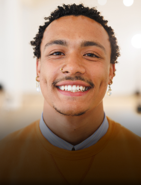 porcelain veneers- west austin dental
