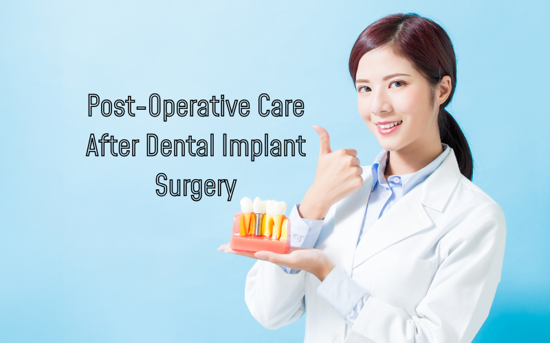 Essential Post-Operative Care for Dental Implants