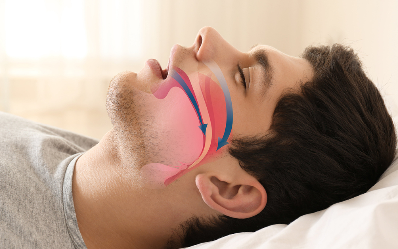 Main cause of snoring